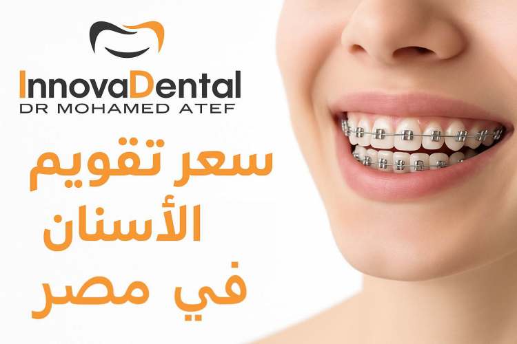 Price Of Orthodontics 2025